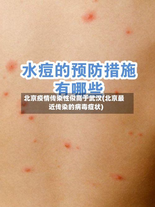 北京疫情传染性似高于武汉(北京最近传染的病毒症状)-第2张图片